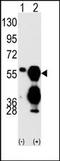 Protein Phosphatase, Mg2+/Mn2+ Dependent 1F antibody, AP15285PU-N, Origene, Western Blot image 