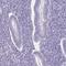 SH3 Domain Containing GRB2 Like 3, Endophilin A3 antibody, PA5-58766, Invitrogen Antibodies, Immunohistochemistry frozen image 