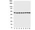 MDM2 Proto-Oncogene antibody, R30449, NSJ Bioreagents, Western Blot image 