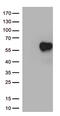 IL2RA antibody, TA813473, Origene, Western Blot image 