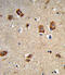 Integrin Subunit Alpha 1 antibody, 63-654, ProSci, Immunohistochemistry paraffin image 