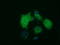 Histone deacetylase 10 antibody, LS-C114833, Lifespan Biosciences, Immunofluorescence image 