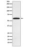 RAD23 Homolog A, Nucleotide Excision Repair Protein antibody, M03243, Boster Biological Technology, Western Blot image 