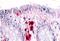 Macrophage Stimulating 1 Receptor antibody, NBP1-02377, Novus Biologicals, Immunohistochemistry frozen image 