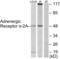 Adrenoceptor Alpha 2A antibody, LS-B7669, Lifespan Biosciences, Western Blot image 