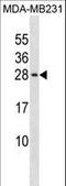 Peptidylprolyl Cis/Trans Isomerase, NIMA-Interacting 4 antibody, LS-C158662, Lifespan Biosciences, Western Blot image 