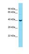 Protein-L-Isoaspartate (D-Aspartate) O-Methyltransferase Domain Containing 2 antibody, orb325422, Biorbyt, Western Blot image 