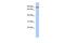 KN Motif And Ankyrin Repeat Domains 3 antibody, GTX45175, GeneTex, Western Blot image 