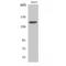 Integrin Subunit Alpha 3 antibody, LS-C384140, Lifespan Biosciences, Western Blot image 