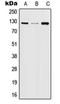 Janus Kinase 2 antibody, orb214136, Biorbyt, Western Blot image 