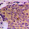 Signal Transducer And Activator Of Transcription 5A antibody, LS-C354085, Lifespan Biosciences, Immunohistochemistry paraffin image 