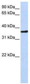 Cysteine And Histidine Rich Domain Containing 1 antibody, TA334433, Origene, Western Blot image 