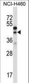 Cellular Communication Network Factor 2 antibody, LS-C167128, Lifespan Biosciences, Western Blot image 