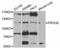 Phosphatidylinositol-4,5-Bisphosphate 3-Kinase Catalytic Subunit Beta antibody, LS-C331181, Lifespan Biosciences, Western Blot image 