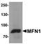 Mitofusin 1 antibody, A02172, Boster Biological Technology, Western Blot image 