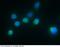 Interleukin 1 Receptor Antagonist antibody, 10123-R004, Sino Biological, Immunohistochemistry paraffin image 