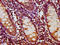 Hydroxypyruvate Isomerase (Putative) antibody, LS-C680625, Lifespan Biosciences, Immunohistochemistry paraffin image 