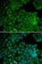 Cyclin Dependent Kinase 7 antibody, LS-C331642, Lifespan Biosciences, Immunofluorescence image 