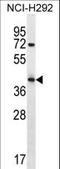 Arrestin Domain Containing 5 antibody, LS-C156517, Lifespan Biosciences, Western Blot image 