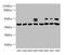 Hypoxia Inducible Factor 1 Subunit Alpha Inhibitor antibody, CSB-PA865160LA01HU, Cusabio, Western Blot image 
