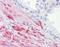 ADAM Metallopeptidase With Thrombospondin Type 1 Motif 17 antibody, orb89809, Biorbyt, Immunohistochemistry paraffin image 