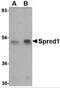 Sprouty Related EVH1 Domain Containing 1 antibody, NBP2-81926, Novus Biologicals, Western Blot image 