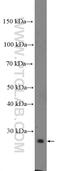 Insulin Like Growth Factor Binding Protein 4 antibody, 18500-1-AP, Proteintech Group, Western Blot image 