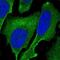 Sterile Alpha Motif Domain Containing 1 antibody, NBP2-58972, Novus Biologicals, Immunocytochemistry image 