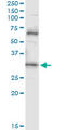 Prodynorphin antibody, LS-C197872, Lifespan Biosciences, Immunoprecipitation image 