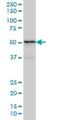 Tripartite Motif Containing 49 antibody, H00057093-M01, Novus Biologicals, Western Blot image 