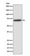 Perilipin 1 antibody, M03918, Boster Biological Technology, Western Blot image 