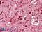 Achaete-Scute Family BHLH Transcription Factor 3 antibody, GTX01091, GeneTex, Immunohistochemistry paraffin image 