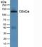 Jagged Canonical Notch Ligand 1 antibody, LS-C304082, Lifespan Biosciences, Western Blot image 