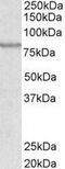 ATP Binding Cassette Subfamily B Member 5 antibody, GTX88894, GeneTex, Western Blot image 