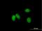Potassium Channel Tetramerization Domain Containing 18 antibody, H00130535-B01P, Novus Biologicals, Immunocytochemistry image 