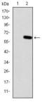 Hereditary hemochromatosis protein antibody, GTX60503, GeneTex, Western Blot image 