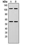 Nuclear Factor Kappa B Subunit 1 antibody, MBS8208269, MyBioSource, Western Blot image 