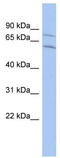 CCR4-NOT Transcription Complex Subunit 2 antibody, TA331125, Origene, Western Blot image 