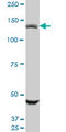 Ubiquitin Specific Peptidase 45 antibody, LS-C134115, Lifespan Biosciences, Western Blot image 