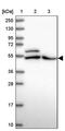 ADP Dependent Glucokinase antibody, PA5-60945, Invitrogen Antibodies, Western Blot image 