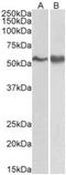 FYN Proto-Oncogene, Src Family Tyrosine Kinase antibody, NB300-928, Novus Biologicals, Western Blot image 