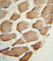 Actin Related Protein 2/3 Complex Subunit 1A antibody, 62-296, ProSci, Immunohistochemistry paraffin image 
