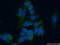 StAR-related lipid transfer protein 3 antibody, 20292-1-AP, Proteintech Group, Immunofluorescence image 