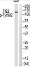 TEK Receptor Tyrosine Kinase antibody, abx012630, Abbexa, Western Blot image 