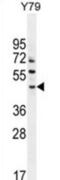 AFG1 Like ATPase antibody, abx025801, Abbexa, Western Blot image 