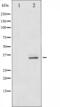 Cyclin Dependent Kinase 5 antibody, abx010548, Abbexa, Western Blot image 