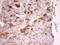 SRBC antibody, M01998, Boster Biological Technology, Immunohistochemistry paraffin image 