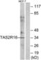 Taste 2 Receptor Member 16 antibody, LS-C120958, Lifespan Biosciences, Western Blot image 