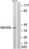 Abhydrolase Domain Containing 6 antibody, GTX87697, GeneTex, Western Blot image 