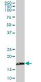 NADH:Ubiquinone Oxidoreductase Subunit B6 antibody, H00004712-B01P, Novus Biologicals, Western Blot image 